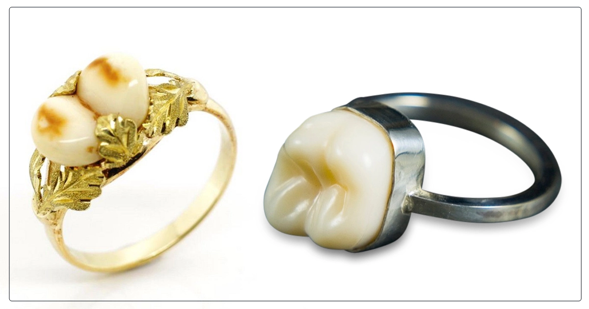 Deer Teeth Ring